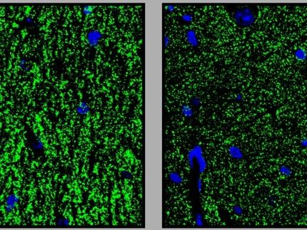 Intelligence deficit: Conclusion from the mouse to the human being