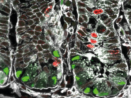 Stammzellen im Darm: Neue Erkenntnisse könnten Weg für die Behandlung zahlreicher Krankheiten ebnen