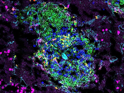 Functionality of immune cells in early life