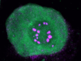 El nuevo enfoque explica cómo los complejos de proteínas regulan los genes del cáncer