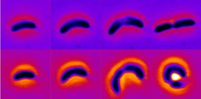 By changing their shape, some bacteria can grow more resilient to antibiotics