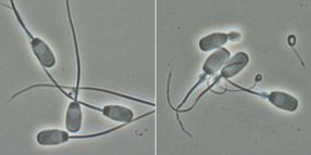 Spermiendefekt bei Ebern beruht auf ungewöhnlicher Mutation