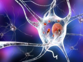 Function identified of 'mystery protein' that kills brain cells of people with Parkinson's