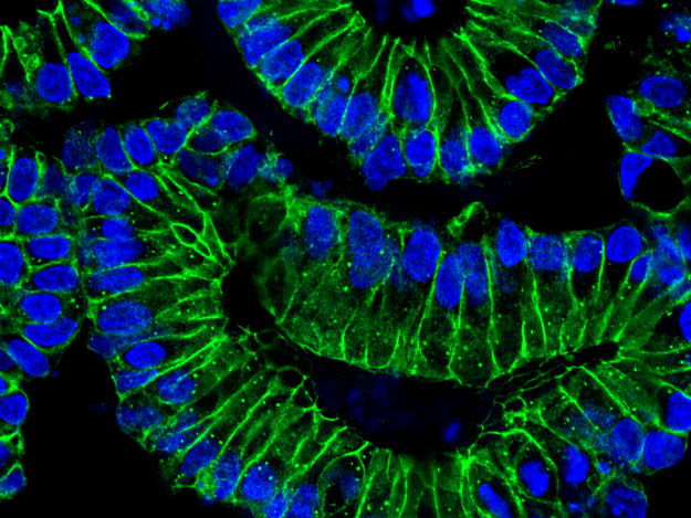 © Sigal Lab, Charité/MDC