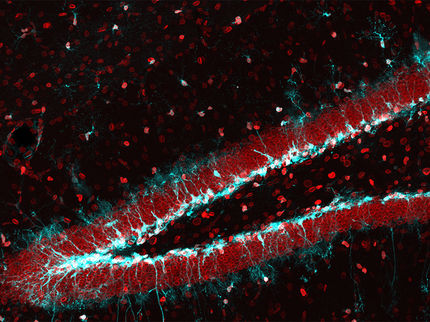 Reactivating Aging Stem Cells in the Brain