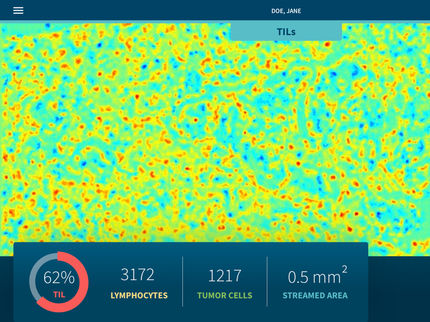 KI-basiertes Analyse-System für die Brustkrebsdiagnose entwickelt