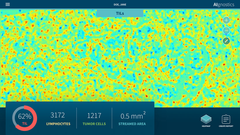 Cancer and AI-based image analysis