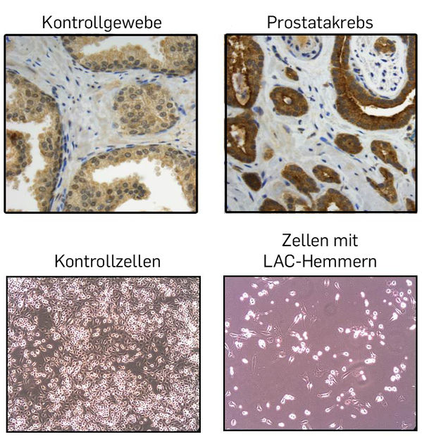 © modifiziert nach Journal of Biological Chemistry