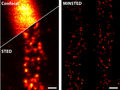 Un nuevo método de microscopía resuelve moléculas fluorescentes con resolución a escala nanométrica