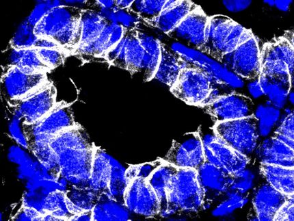 Detonating fuse for breast cancer discovered