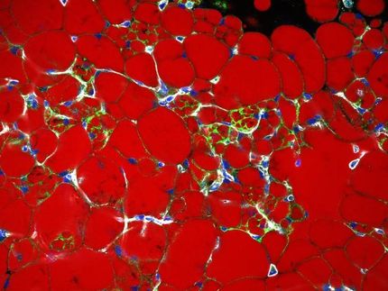 Adipocitos beige en tejido adiposo blanco. (Adipocitos beige con UCP-1 teñido en verde. Los lípidos son rojos y la F-actina, que delinea las células y especialmente los vasos sanguíneos, es gris, el ADN es azul).
