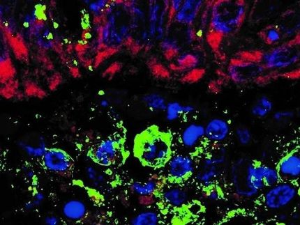 Biopsia de tejido de colon infectado por el SARS-CoV-2 y teñido por inmunofluorescencia para la proteína humana ACE2 (rojo) y la proteína viral de la espiga (verde). Los núcleos celulares se tiñen de azul