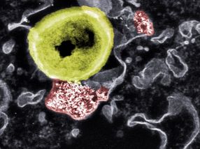 Mit Nanopartikeln gegen gefährliche Bakterien