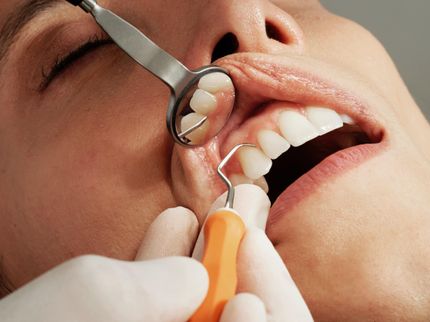 Erstmals alle Zellen menschlicher Zähne detailliert entschlüsselt