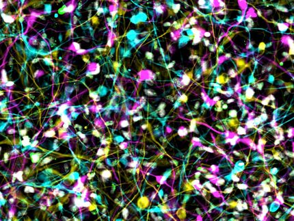 Alzheimer-Modellierung zeigt überraschende Ergebnisse