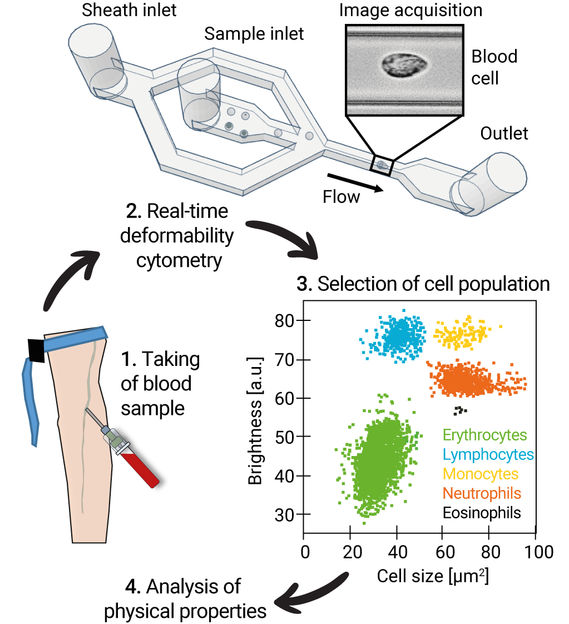 How a corona infection changes blood cells in the long run - Method could help as an early warning system to detect future pandemics by unknown viruses