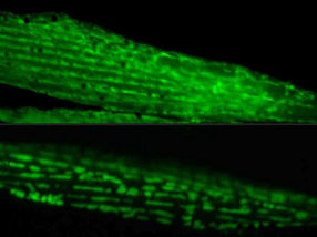 Arriba: Mitocondrias en músculo sano de C. elegans. Abajo: mitocondrias fragmentadas en el músculo tras la inducción de la agregación de proteínas en la línea germinal.