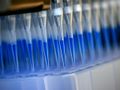 Blue-stained swab material from corona tests is prepared for analysis in a sequencing device with the help of a laboratory robot.