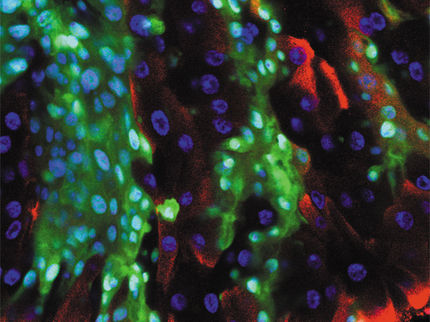 Gekaperter Immun-Aktivator fördert Wachstum und Ausbreitung von Darmkrebs
