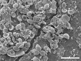 Mikroplastik in Böden wird von krankheitserregenden Pilzen besiedelt
