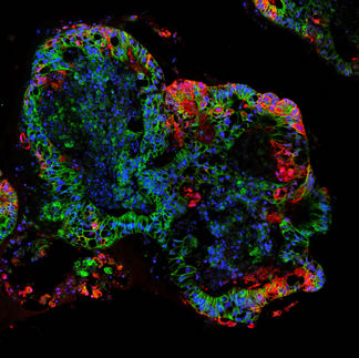 Coronavirus kapert antivirale Immunfaktoren