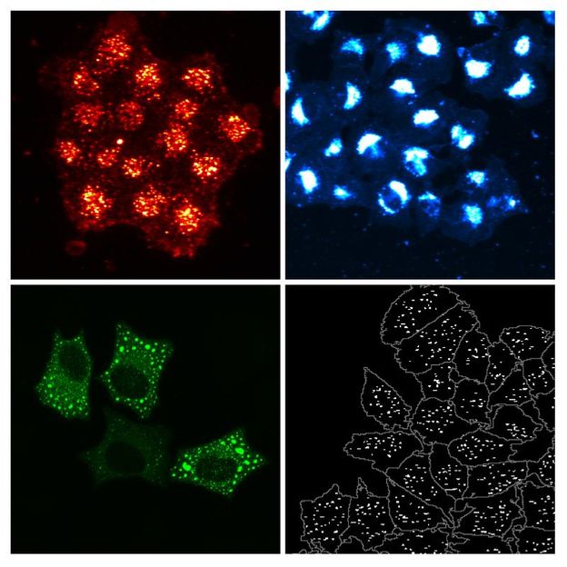 PLoS Genetics ; Peter Blattmann/EMBL und Christian Schuberth/ Universitätsklinikum Heidelberg.