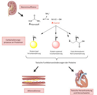 Dialyse: Blutprotein als Risikofaktor