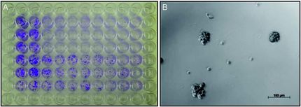 Bösartige Hirntumoren: Neue Strategien zur Überwindung der Therapieresistenz