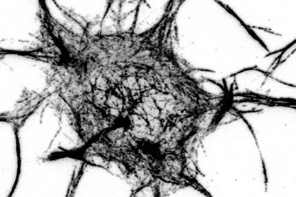 Wo die Knochen verletzter Nervenzellen heilen