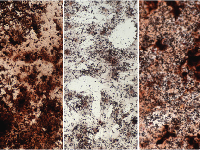 Fountain of youth for ageing stem cells in bone marrow - Epigenetic changes in old age increase risk of osteoporosis and bone fractures