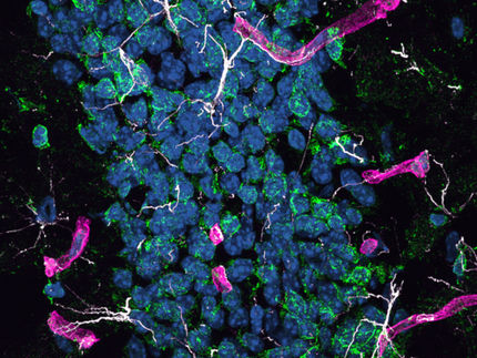 Una proteína del hígado puede causar la enfermedad de Alzheimer en el cerebro