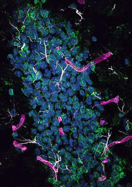 John Charles Louis Mamo, Lam V et al., 2021, PLOS Biology, CC BY 4.0 (https://creativecommons.org/licenses/by/4.0/)