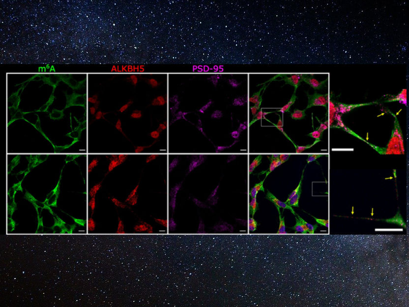 Wissenschaftler gewinnen neue Erkenntnisse darüber, wie Gehirnzellen miteinander sprechen - Forschung könnte bei der Behandlung von psychischen Erkrankungen und Gedächtniskrankheiten helfen