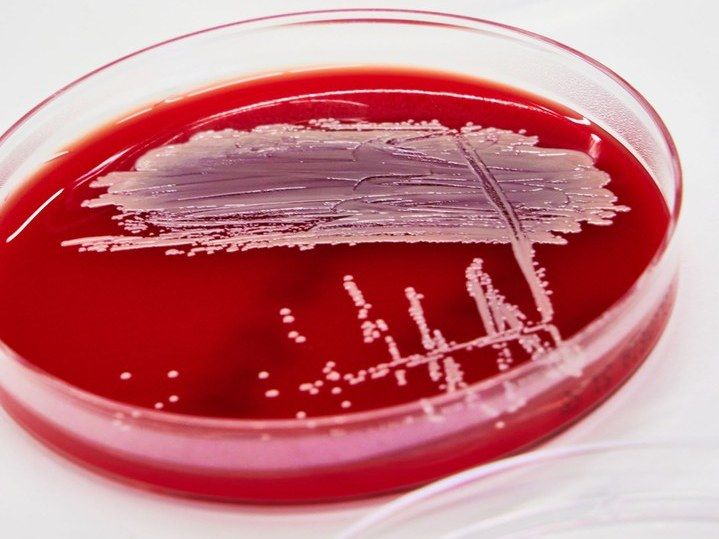 Wie Staphylokokken sich gegen Antibiotika schützen - Studie klärt bislang unbekannten Resistenzmechanismus auf