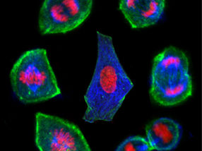 Mit optischer Pinzette den Lebenszyklus der Zelle erfühlen