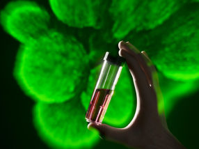 Stem cells from the bioreactor