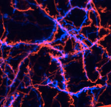 Calcium in the nucleus renders neurons chronically sensitive to pain