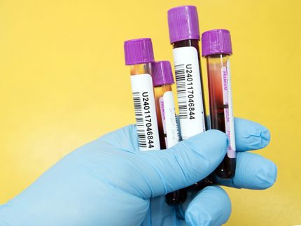 Identifican un biomarcador sanguíneo que predice la diabetes tipo 2 muchos años antes del diagnóstico