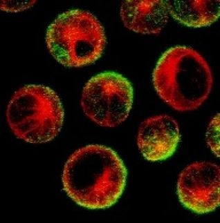 Cancerous B cells treated with rituximab