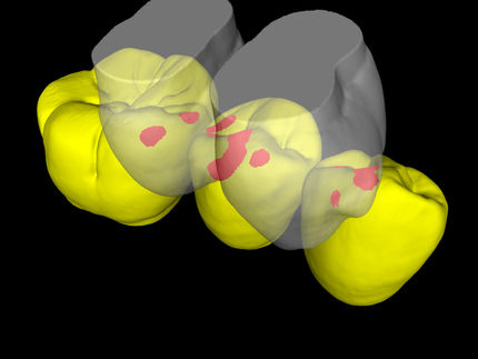 Material loss protects teeth against fatigue failure