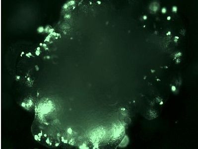 Wie wird ein Fledermaus-Coronavirus zum Pandemie-Auslöser?