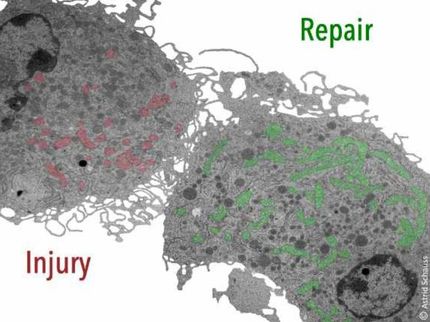 Defense or repair: How immune cells are controlled during wound healing