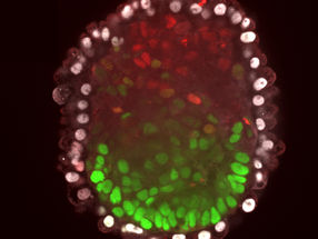 Stammzellen organisieren sich selbsttätig zum Embryoid