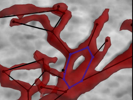 Covid-19 can cause vascular damage to the heart