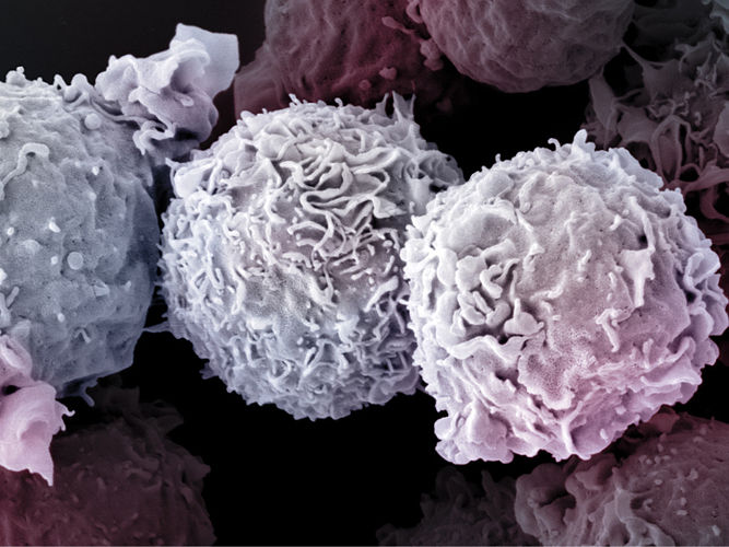 Electron microscope image of T cells: Nano Imaging Lab SNI/Biozentrum, University of Basel