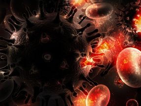 Infektion mit HIV: Das Reservoir des Virus im Körper besser verstehen