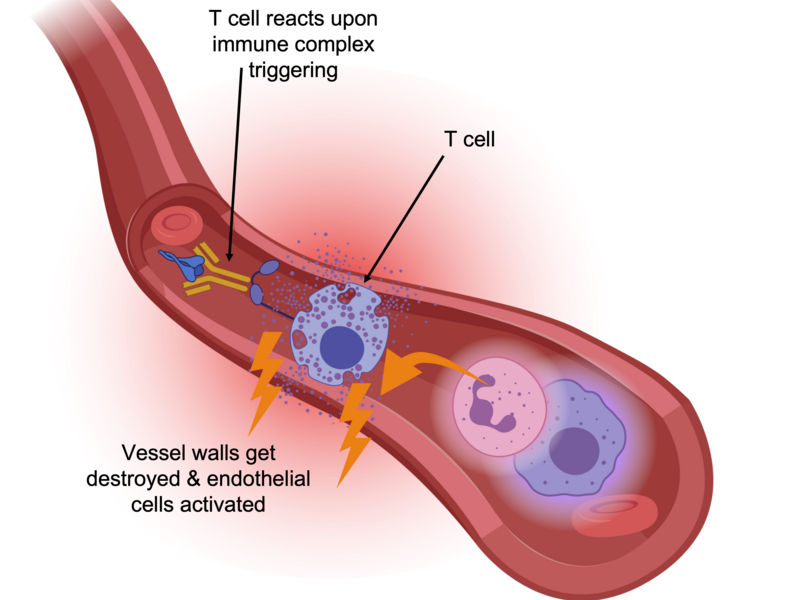 The fatal role of T cells in COVID-19 - Safety mechanism is put out of action