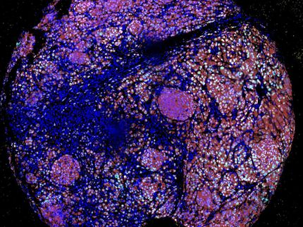 Neues Forschungsprojekt soll Immunzellen schlauer als den Krebs machen