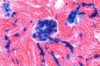 Stich ohne Schrecken