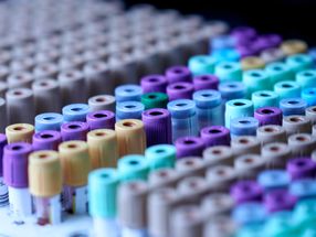 PCR-Labore vor schwierigen Investitionsentscheidungen